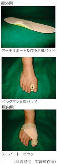 外反母趾