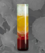 PRP