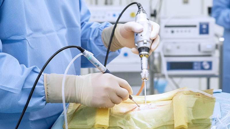 低侵襲脊椎内視鏡手術