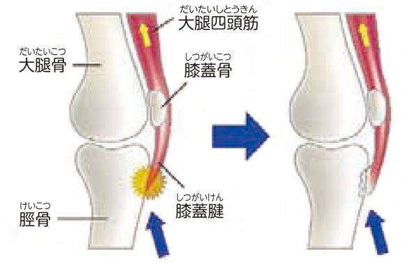 骨の状態
